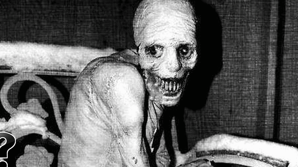 A horrifying photo of one of the test subjects. Engorged eyes, skinny, beastly man. The Russian Sleep Experiment.